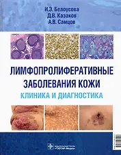 Лимфопролиферативные заболевания кожи. Клиника и диагностика