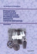 Ортопедическое лечение больных с отсутствием зубов при помощи коротких имплантатов с пористой поверхностью