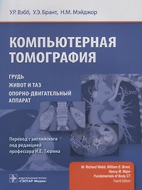 Компьютерная томография.