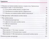 Заболевания шейки матки. Современные подходы к диагностике и - 2