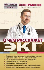 О чем расскажет ЭКГ