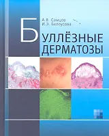 Буллезные дерматозы