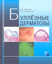 Буллезные дерматозы