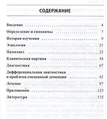 Хроническая цереброваскулярная недостаточность - 1