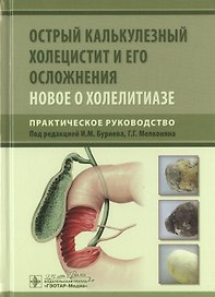 Острый калькулезный холецистит и его осложнения. Новое о холелитиазе. Практическое руководство