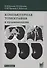 Компьютерная томография в пульмонологии - 2
