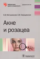 Акне и розацеа