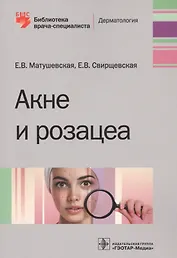 Акне и розацеа