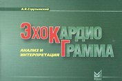 Эхокардиограмма: анализ и интерпретация