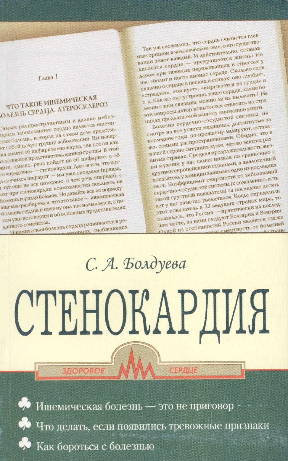 

Стенокардия