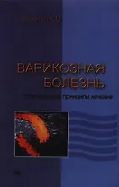 Варикозная болезнь. Современные принципы лечения