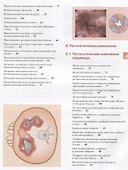 Гастроскопия - 2