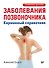Заболевания позвоночника. Карманный справочник - 0