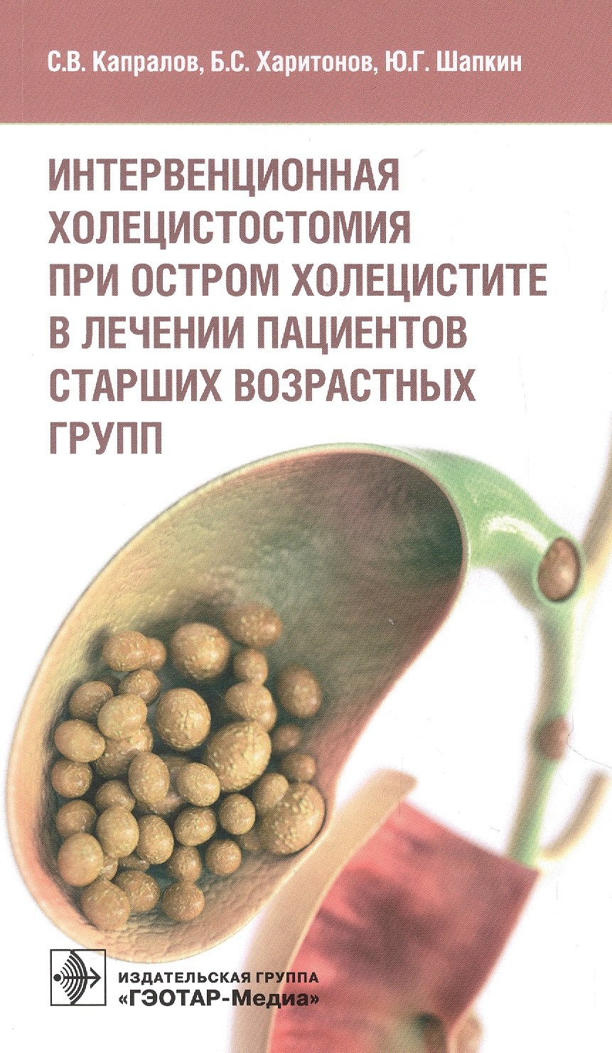 

Интервенционная холецистостомия при остром холецистите в лечении пациентов старших возрастных групп