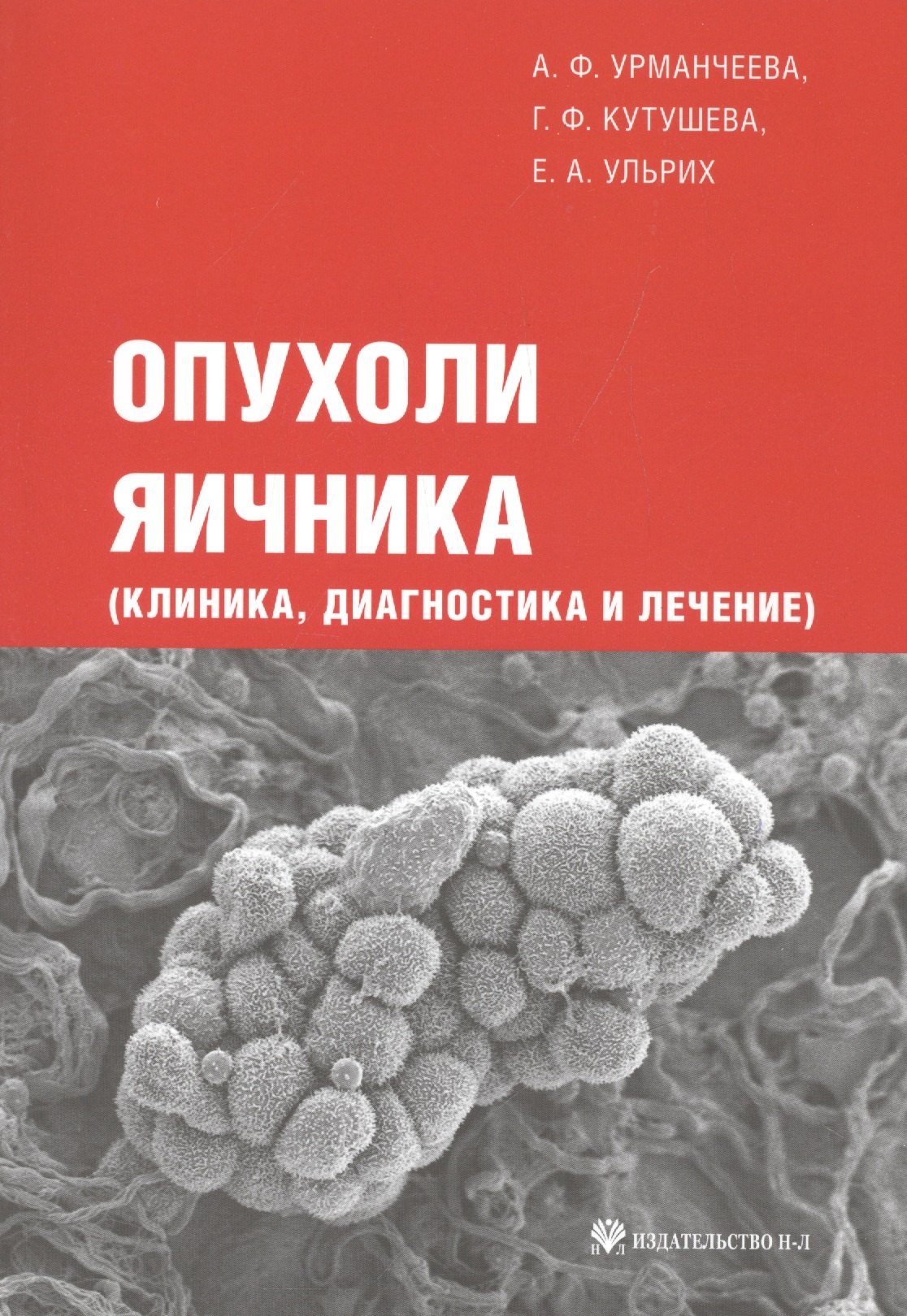 

Опухоли яичника (клиника диагностика и лечение)