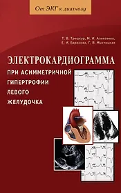 Электрокардиограмма при асимметричной гипертрофии левого желудочка / (мягк) (От ЭКГ к диагнозу). Трешкур Т. и др. (Диля)