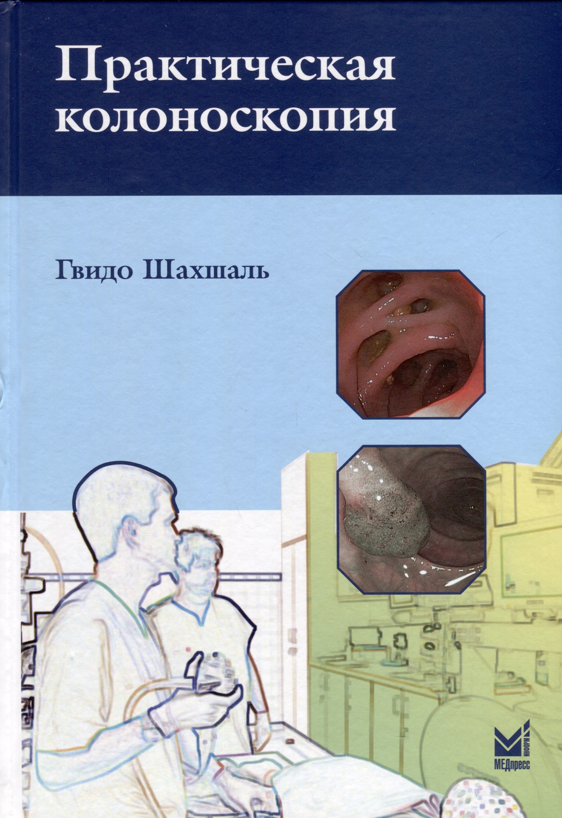 

Практическая колоноскопия