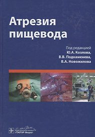 Атрезия пищевода