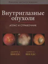 Внутриглазные опухоли. Атлас и справочник