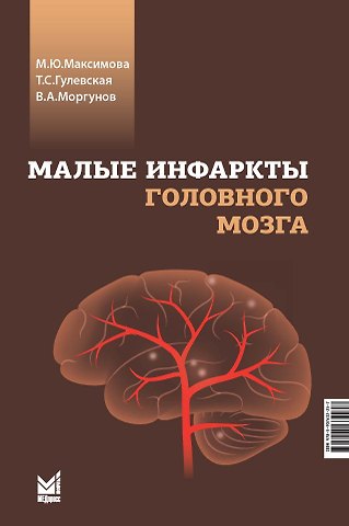 Татьяна Сергеевна Гулевская, Марина Юрьевна Максимова, Владимир Александрович Моргунов Малые инфаркты головного мозга