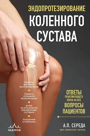 Андрей Петрович Середа Эндопротезирование коленного сустава: ответы практикующего врача на все вопросы пациентов
