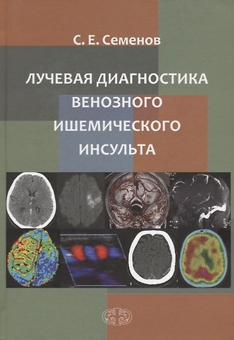 Станислав Евгеньевич Семенов Лучевая диагностика венозного ишемического инсульта