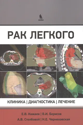 Евгений Васильевич Кижаев Рак легкого. Клиника, диагностика, лечение