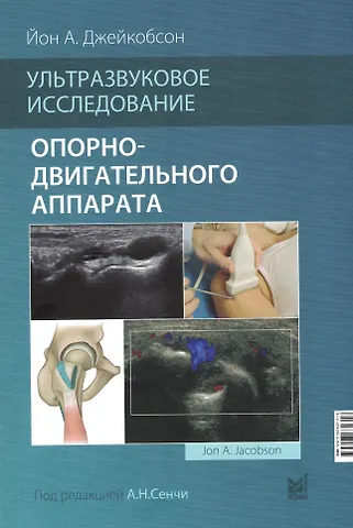 Йон А. Джейкобсон Ультразвуковое исследование опорно-двигательного аппарата
