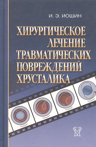 Хирургическое лечение травматических повреждений хрусталика