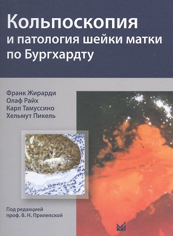 Франк Жирарди Кольпоскопия и патология шейки матки по Бургхардту