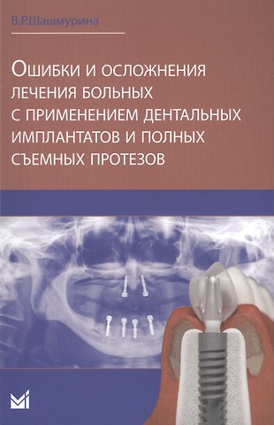 Ошибки и осложнения лечения больных с применением дентальных