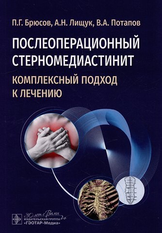 П.Г. Брюсов, Вячеслав Александрович Потапов, Александр Николаевич Лищук Послеоперационный стерномедиастинит. Комплексный подход к лечению