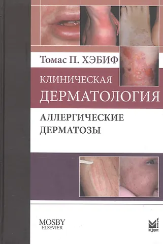 Томас П. Хэбиф Клиническая дерматология. Аллергические дерматозы.