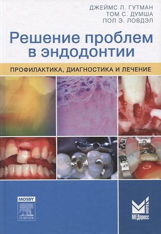 Джеймс Л. Гутман Решение проблем в эндодонтии