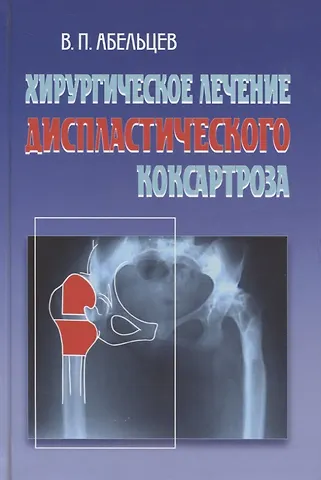 Владимир Петрович Абельцев Хирургическое лечение диспластического коксартроза