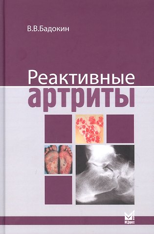 Владимир Васильевич Бадокин Реактивные артриты