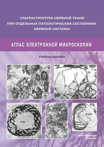 Дмитрий Эдуардович Коржевский, Мирослав Михайлович Одинак Ульстраструктура нервной ткани при отдельных патологических состояниях нервной системы. Атлас электронной микроскопии.
