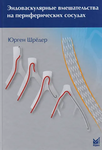 Юрген Шрёдер Эндоваскулярные вмешательства на периферических сосудах